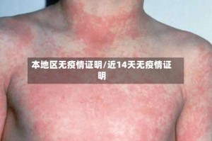 本地区无疫情证明/近14天无疫情证明
